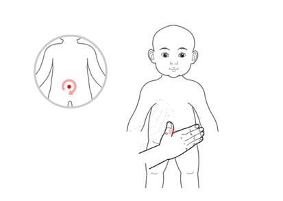 小兒推拿治療感冒嗎？